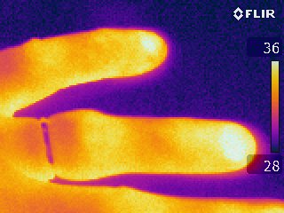Thermography of a human finger