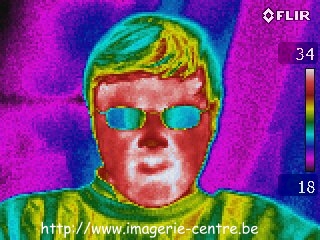 Thermography of this website's administrator