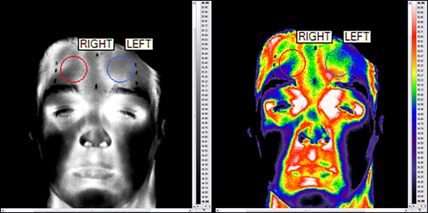 Fichier:Figure thermography comparaison human.jpg