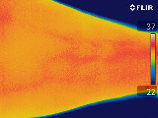 thermography of a forearm