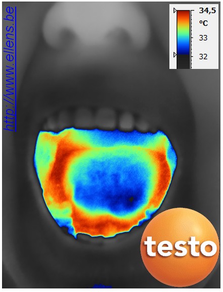 Infrarood thermografie van een tong