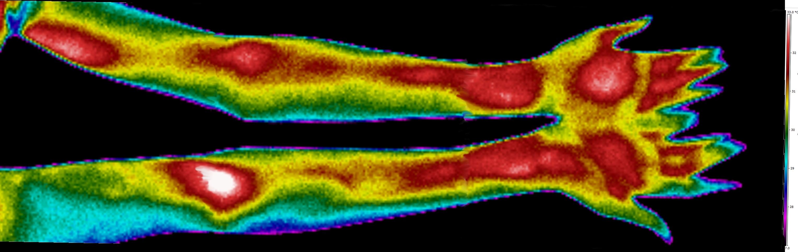 FichierBras.jpg La Librairie Thermographique