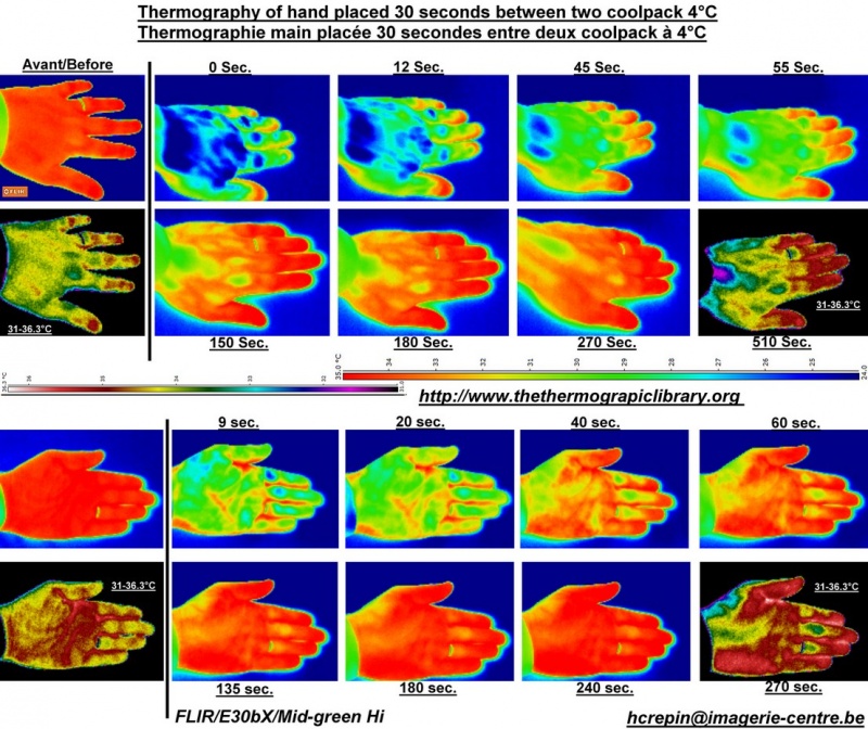 observation in thermography of a hand in dynamic cooling process and restore
