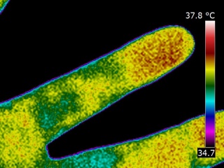 Thermography of a finger, index