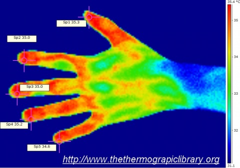 Imagerie thermique d'une main de femme