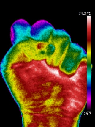Thermography of a closed fist