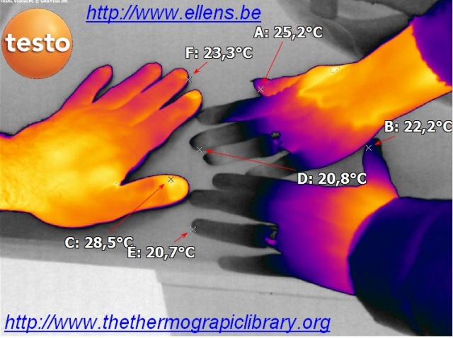 Thermographie infrarouge des différences de températures de mains d'homme et de femme