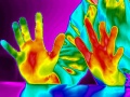 Sclerose-thermographie-ici.jpg