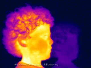 Thermal side view of a young boy
