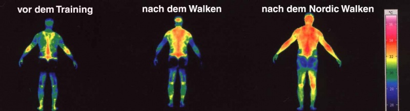 Image infrarouge comparative entre l'état normal, la marche et la marche nordique, source:http://www.pro-nordicwalking.de/vorteile.html, auteur: Kreuzriegler, Gollner, Fichtner: Das ist Nordic Walking, Urban & Fischer Verlag, München 2002