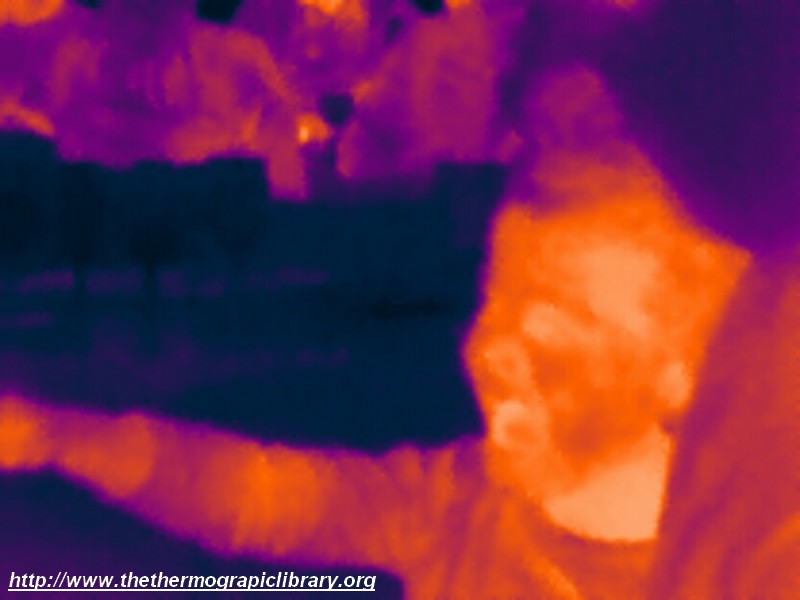 Fichier:Garcon-thermographie-enfant.jpg