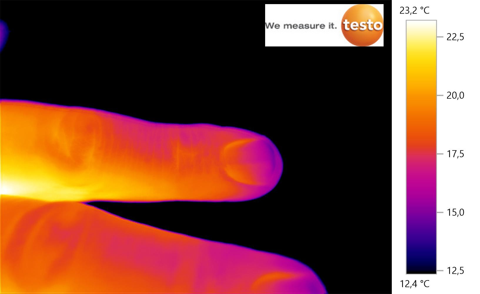 Thermographie d'un doigt en haute résolution