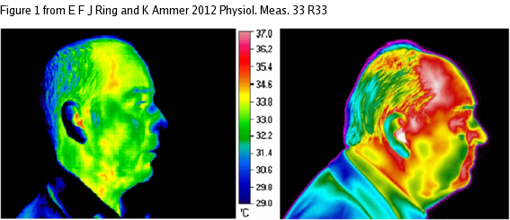 Fichier:Figure-humaine-profil-thermographie.jpg