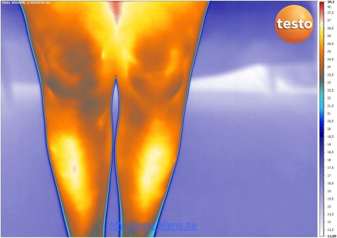 Thermografie van een vrouwelijke knie