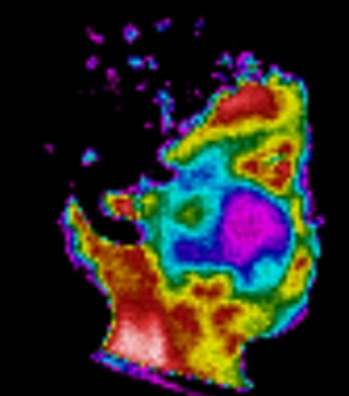 Thermographie de profil de la tête d'un garçonnet, corps humain