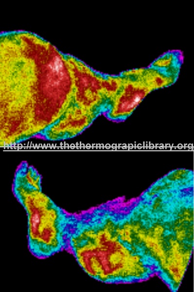 Fichier:Jambes chute thermographie.jpg