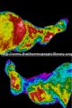 Jambes chute thermographie.jpg