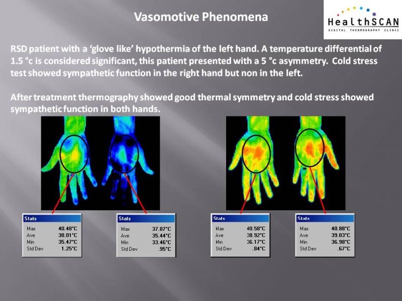 Fichier:Circulation-Thermography-Changes.jpg