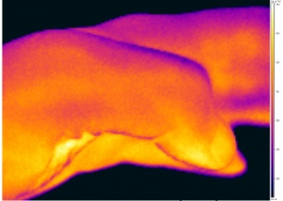 Thermography of a human thumb