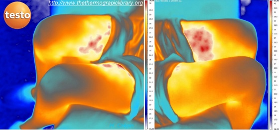 Vision en thermographie infrarouge des cuisses d'une cavalière