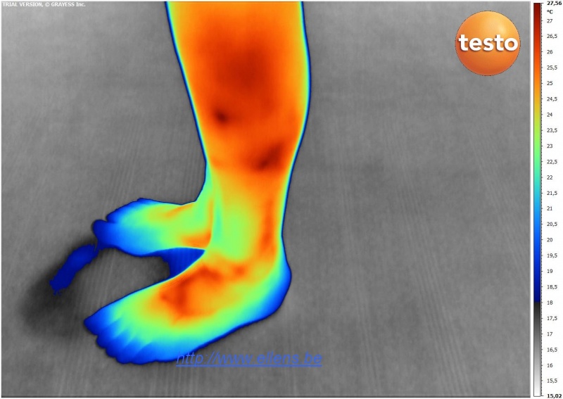 Fichier:Pieds-imagerie-thermographique-testo-890.jpg