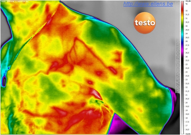 Thermographie d'aisselle avec inflammations