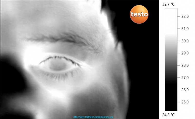 Fichier:Oeil-thermographie-corps-humain-testo-890.jpg