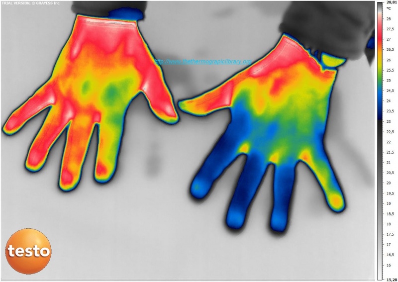 Fichier:Hands-thermography-medical-TESTO-890.jpg