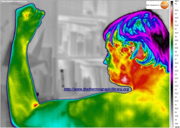 Thermografie van armen