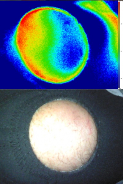 Fichier:Rotule-attelle-thermographie.jpg