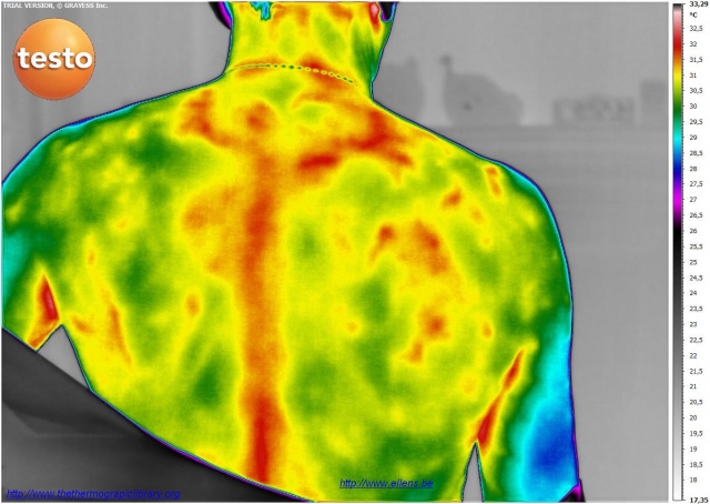 Imagerie thermique d'une personne âgée en mauvaise santé
