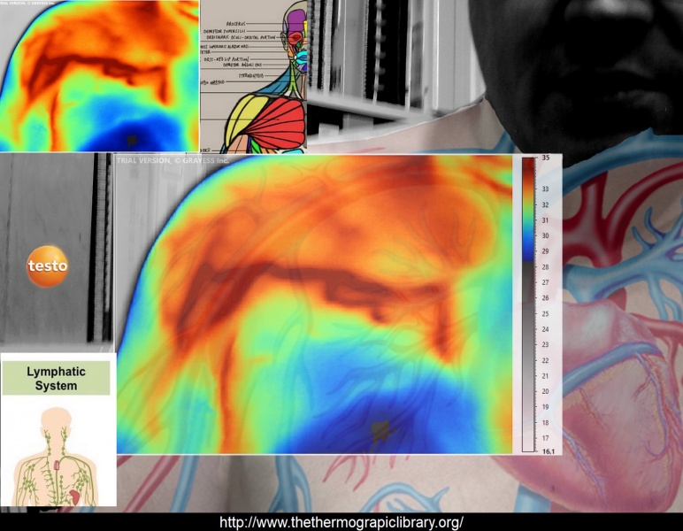 Fichier:Epaule-anatomie-thermographie.jpg