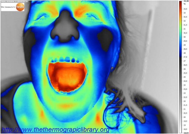 Thermography of an open mouth