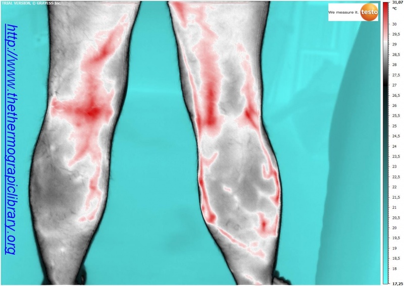 Fichier:Benen-medische-thermographie-testo-890.jpg